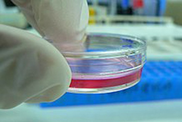 cell culture preparation